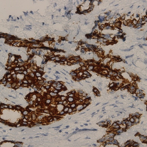 Cytokeratin 16 Antibody in Immunohistochemistry (Paraffin) (IHC (P))