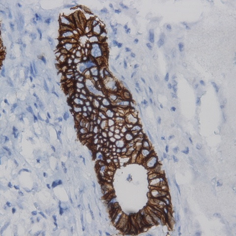 Cytokeratin 19 Antibody in Immunohistochemistry (Paraffin) (IHC (P))