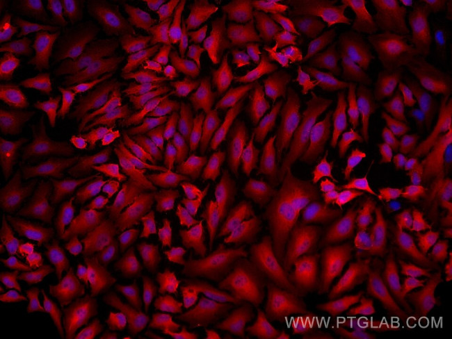 P16-INK4A Antibody in Immunocytochemistry (ICC/IF)