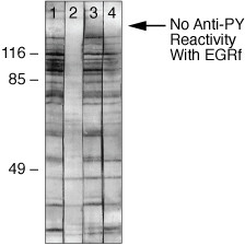 Phosphoserine Antibody in Western Blot (WB)