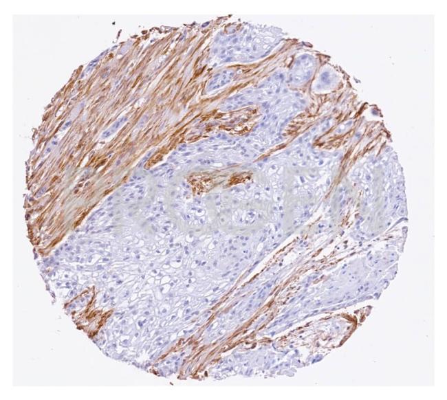 Smooth Muscle Actin Antibody in Immunohistochemistry (Paraffin) (IHC (P))