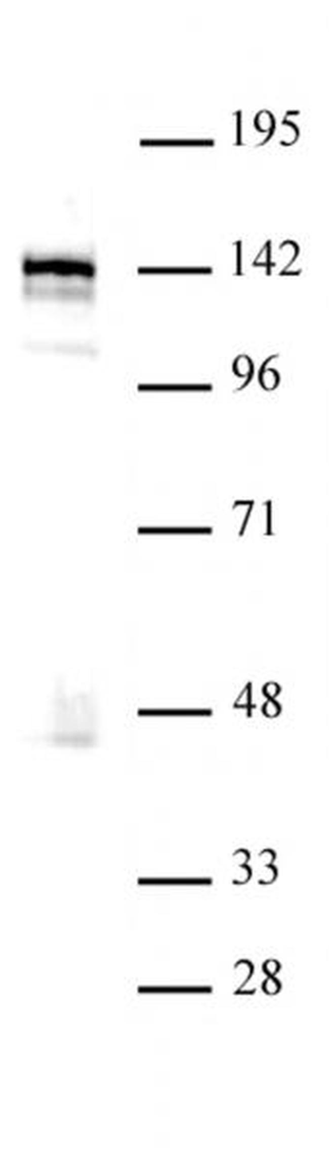 BRD8 / SMAP2 Antibody in Western Blot (WB)
