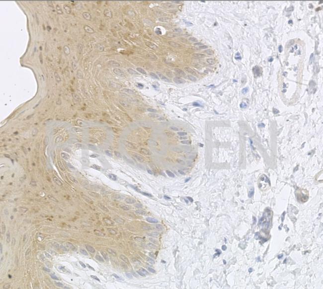 Cytokeratin 13 Antibody in Immunohistochemistry (Paraffin) (IHC (P))
