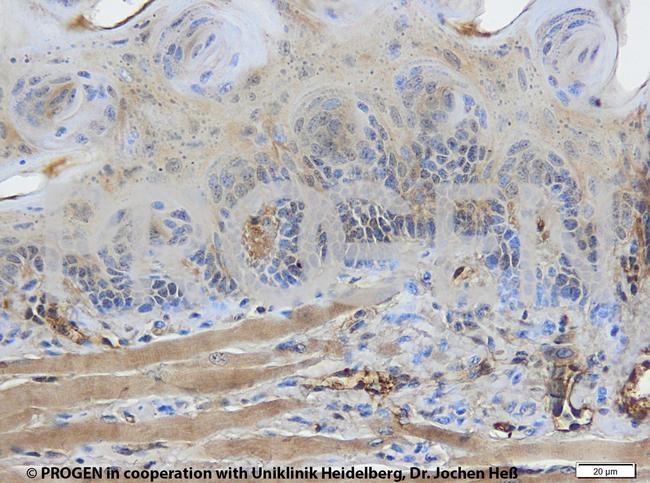Cytokeratin Pan Type I/II Antibody in Immunohistochemistry (IHC)