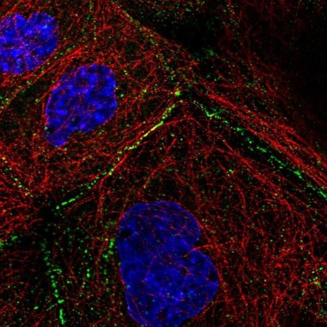 Desmoplakin 1 Antibody in Immunocytochemistry (ICC/IF)
