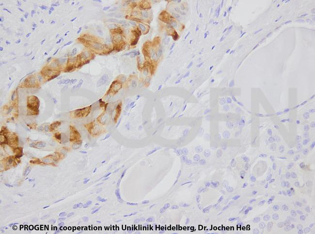 Cytokeratin 7 Antibody in Immunohistochemistry (IHC)