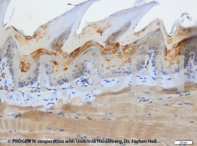 Cytokeratin 5/8 Antibody in Immunohistochemistry (IHC)