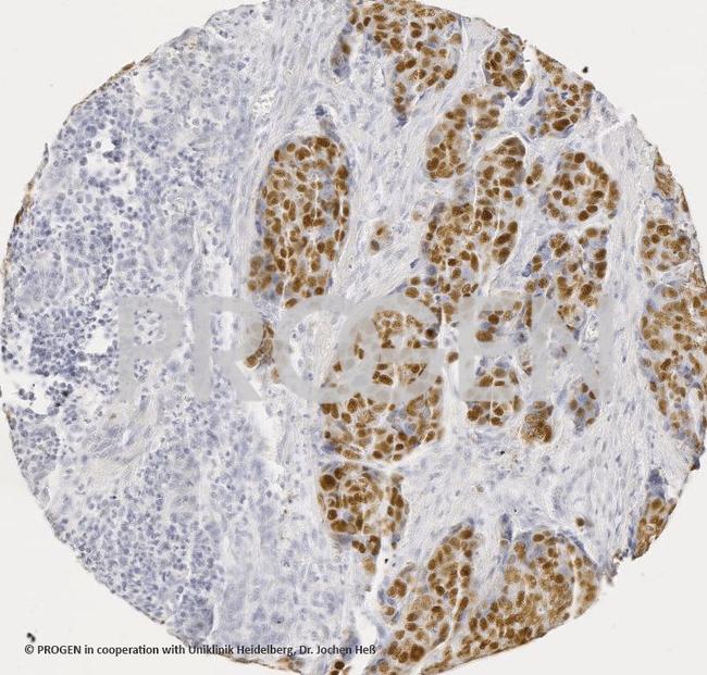 p53 Protein Antibody in Immunohistochemistry (IHC)