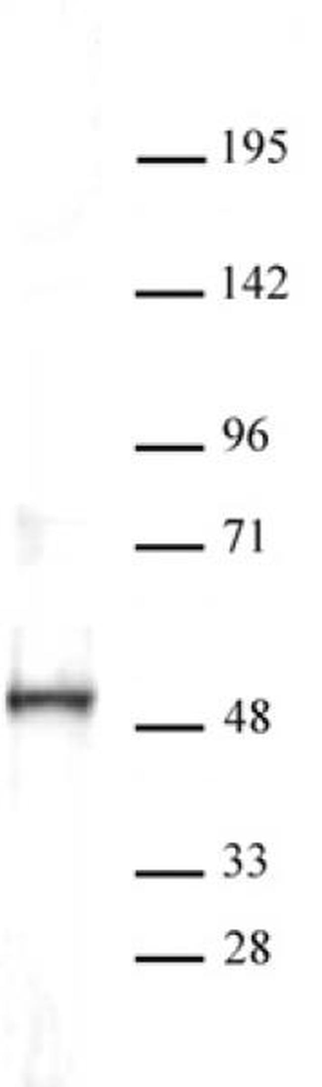 ERR-alpha Antibody in Western Blot (WB)