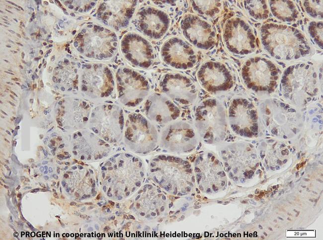 Cytokeratin 20 Antibody in Immunohistochemistry (IHC)