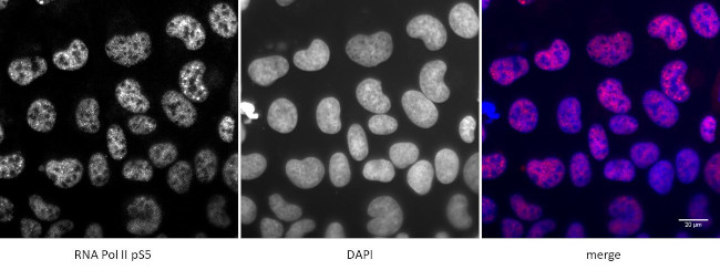 Phospho-RNA pol II CTD (Ser5) Antibody in Immunocytochemistry (ICC/IF)