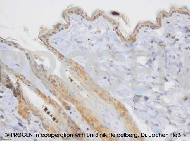 DSC1 Antibody in Immunohistochemistry (IHC)