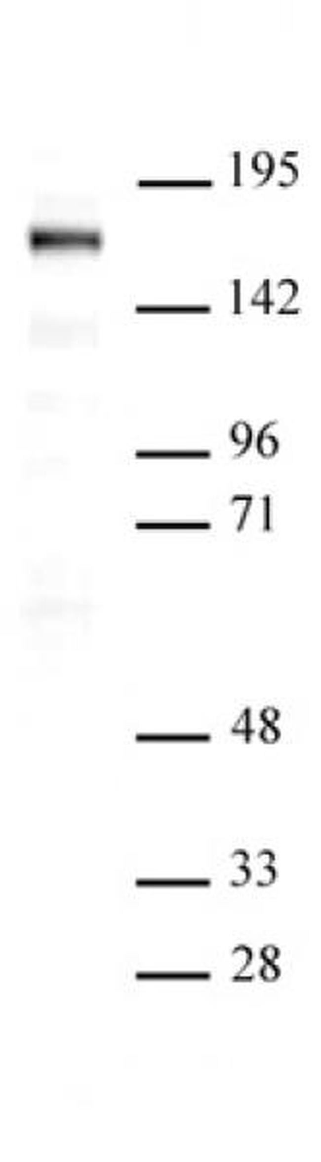 SIP1 Antibody in Western Blot (WB)