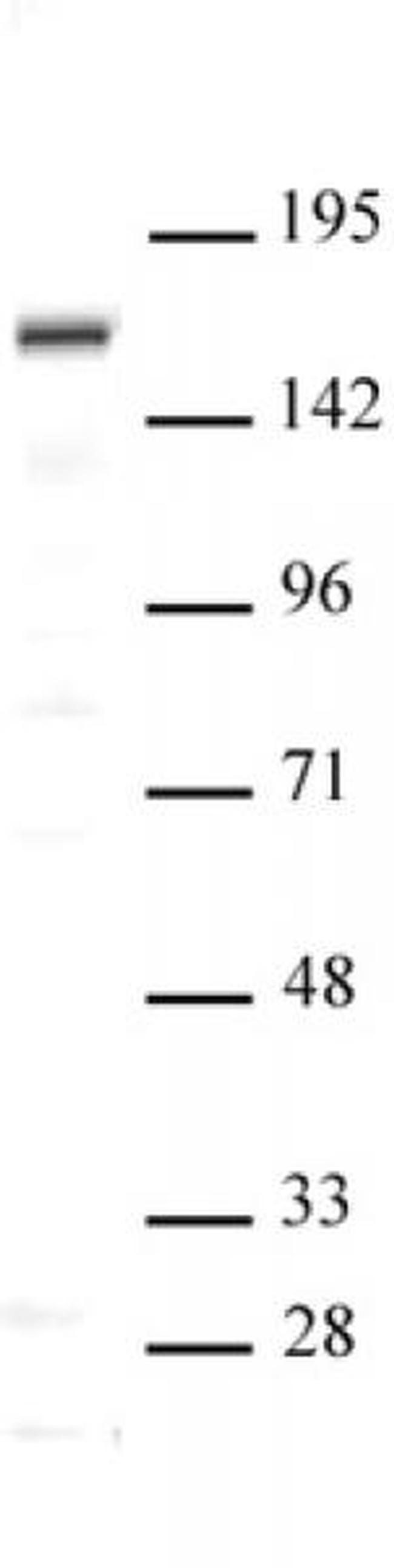 SIP1 Antibody in Western Blot (WB)