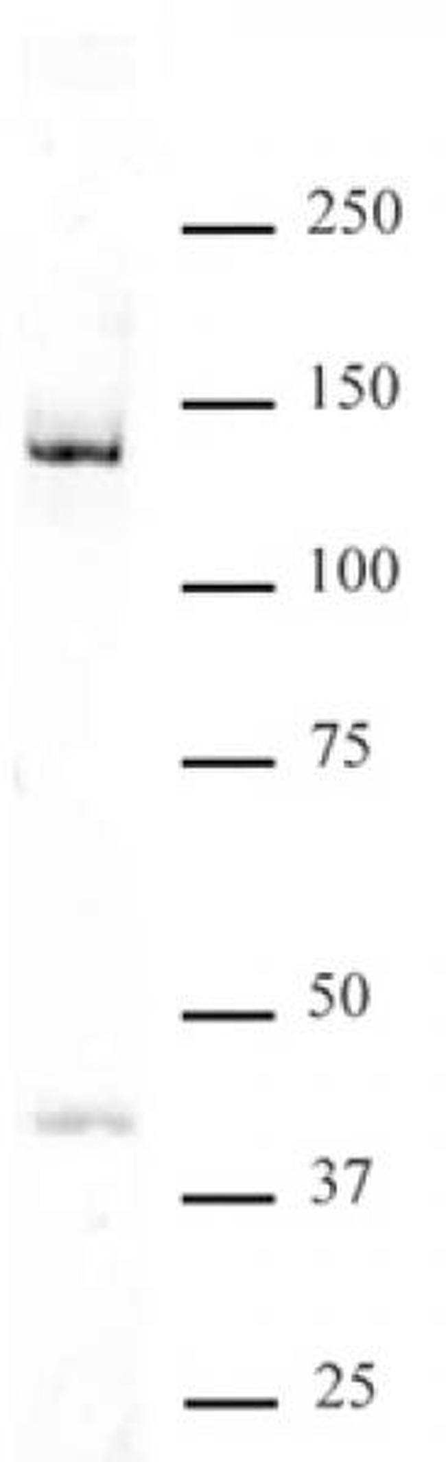 DDB1 Antibody in Western Blot (WB)