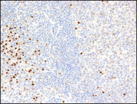 PIM2 Antibody in Immunohistochemistry (Paraffin) (IHC (P))