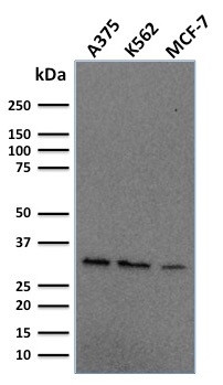 Replication Protein A2 (RPA2) Antibody in Western Blot (WB)