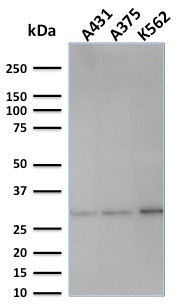 Replication Protein A2 (RPA2) Antibody in Western Blot (WB)