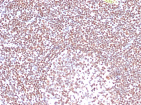 Replication Protein A2 (RPA2) Antibody in Immunohistochemistry (Paraffin) (IHC (P))