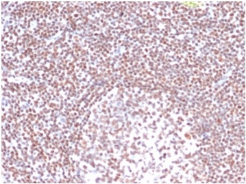 Replication Protein A2 (RPA2) Antibody in Immunohistochemistry (Paraffin) (IHC (P))