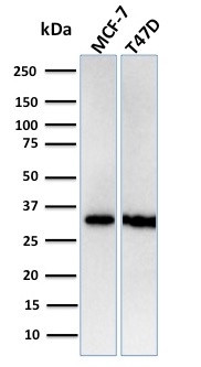 Replication Protein A2 (RPA2) Antibody in Western Blot (WB)