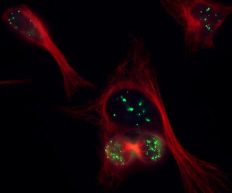 CENP-B Antibody in Immunocytochemistry (ICC/IF)