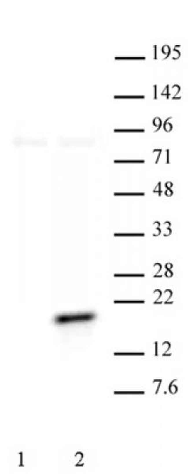 Phospho-Histone H3 (Thr11) Antibody in Western Blot (WB)