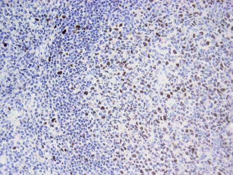 EED Antibody in Immunohistochemistry (Paraffin) (IHC (P))