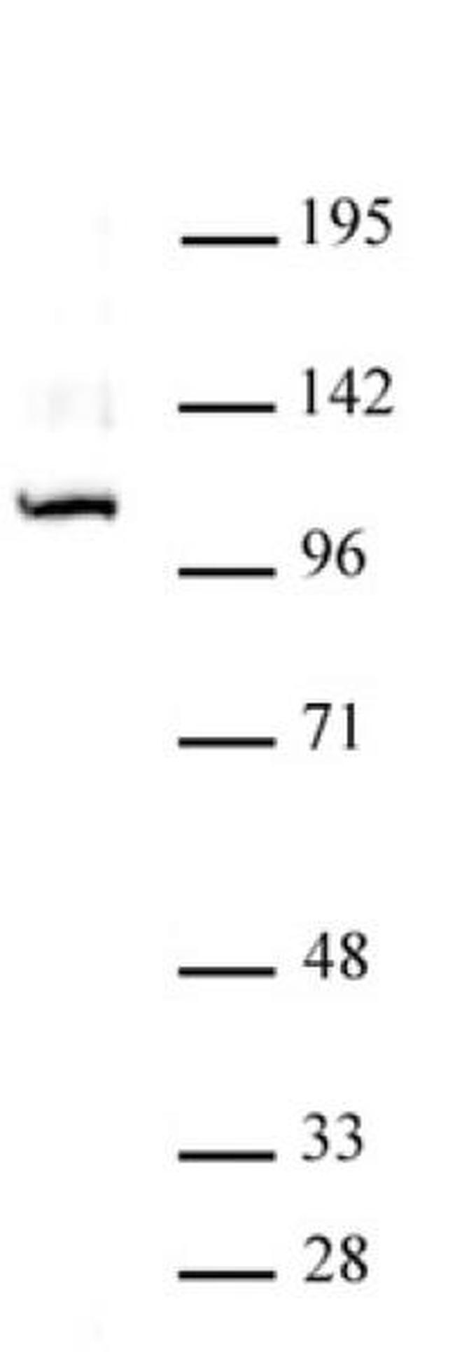GLI1 Antibody in Western Blot (WB)