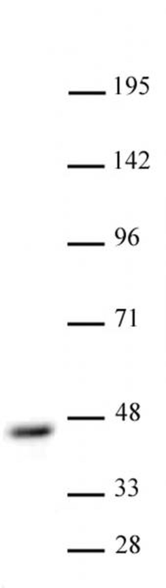 CBX8 Antibody in Western Blot (WB)