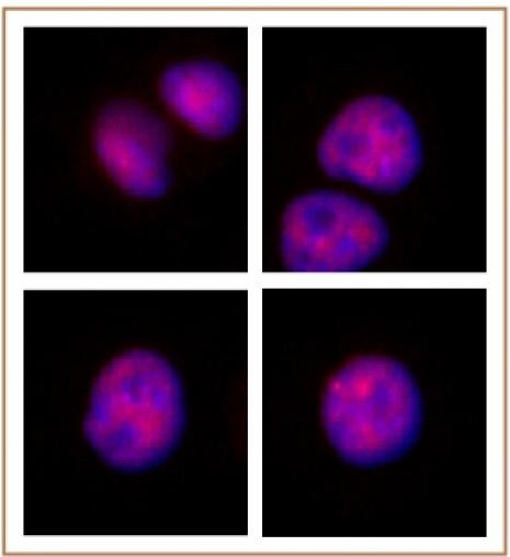 MOF / MYST1 Antibody in Immunocytochemistry (ICC/IF)