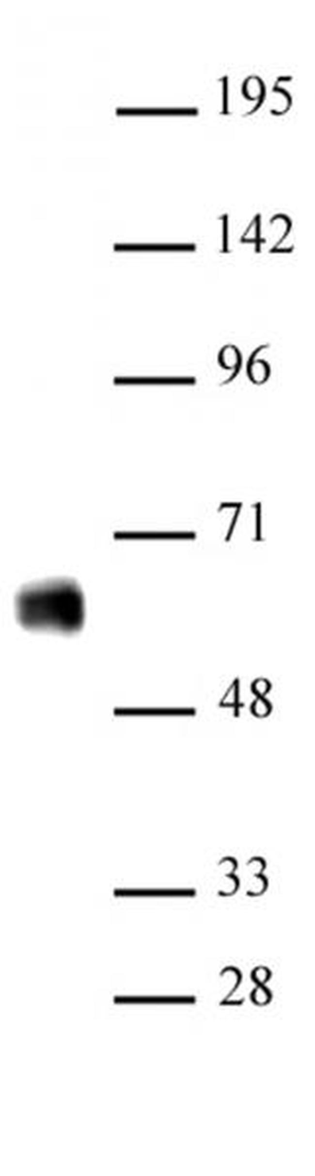 IRF-5 Antibody in Western Blot (WB)