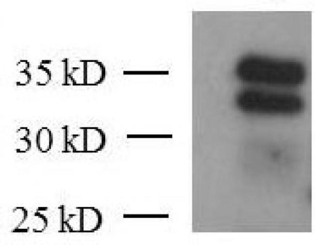 KLF6 Antibody in Western Blot (WB)