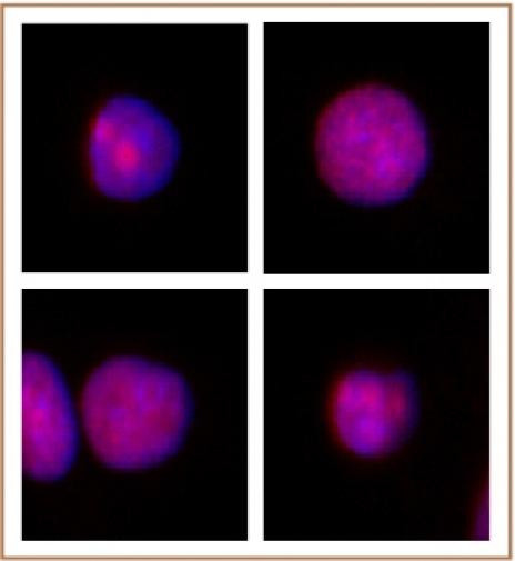 XRCC1 Antibody in Immunocytochemistry (ICC/IF)