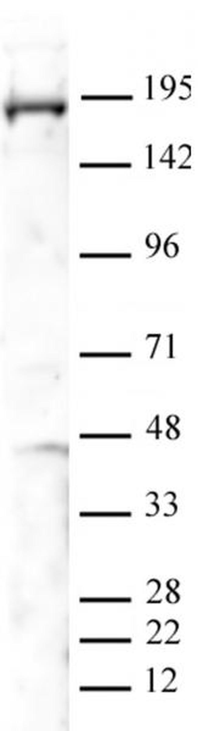 PBRM1 Antibody in Western Blot (WB)