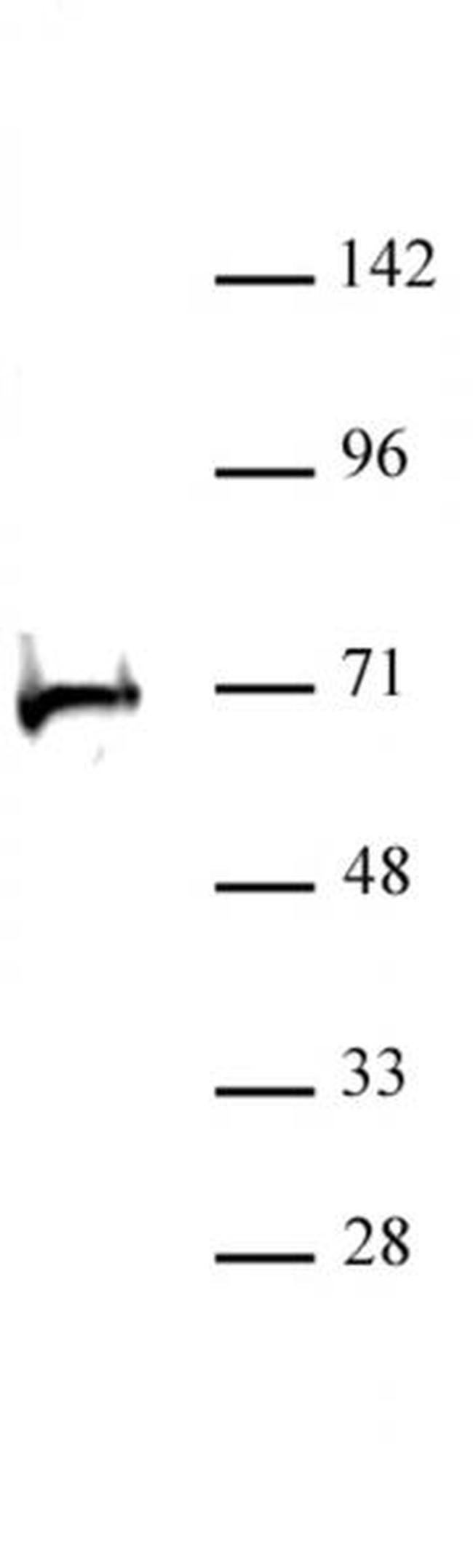 RBBP5 Antibody in Western Blot (WB)