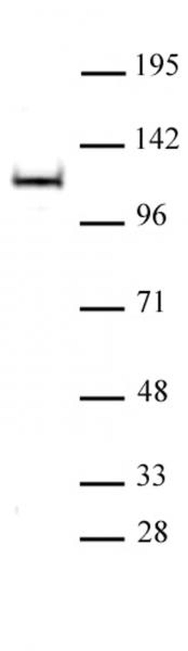 OGA/O-GlcNAcase Antibody in Western Blot (WB)