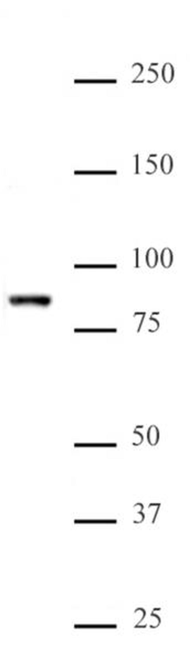KMT2E (MLL5) Antibody in Western Blot (WB)