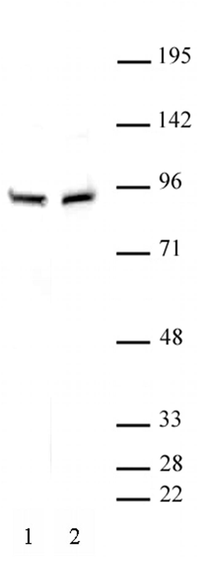 beta-Catenin Antibody in Western Blot (WB)