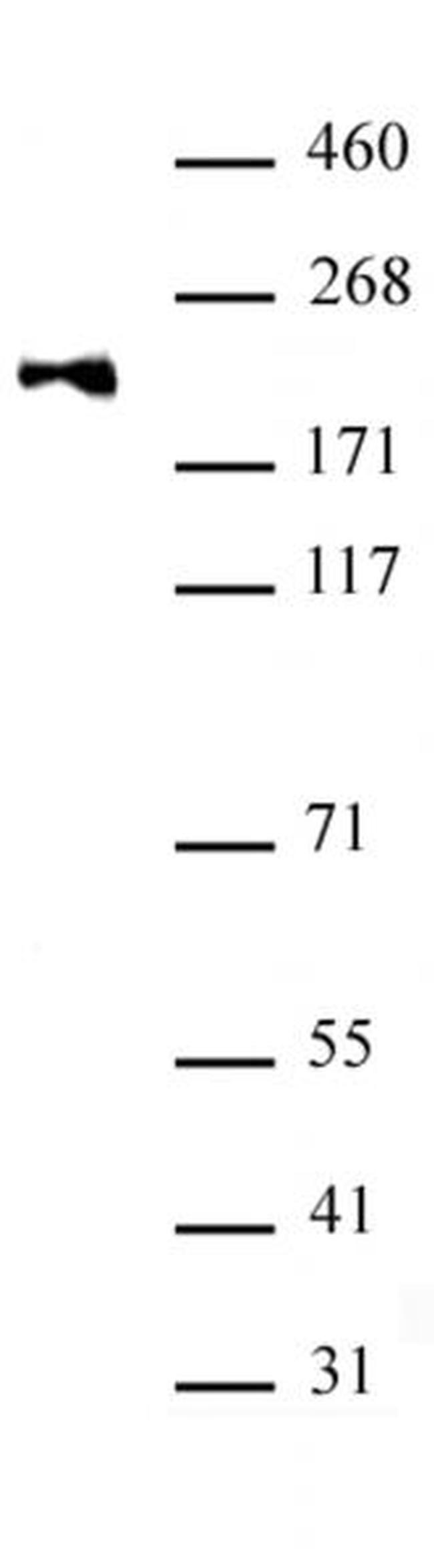 DNMT1 monomethyl (Lys142) Antibody in Western Blot (WB)