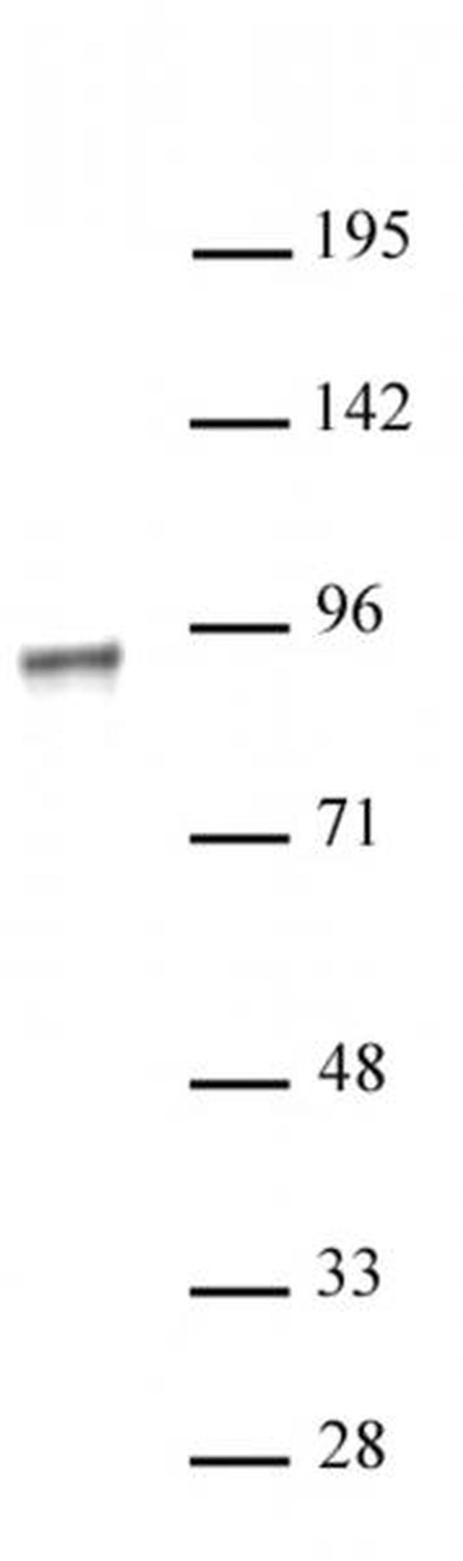 NR3C1 Antibody in Western Blot (WB)