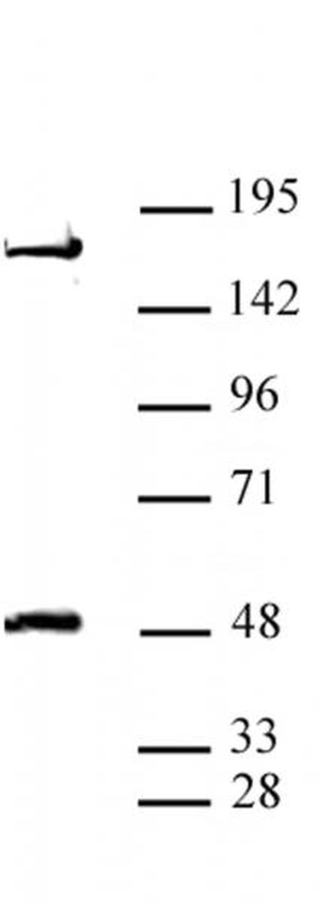 AEBP2 Antibody in Western Blot (WB)