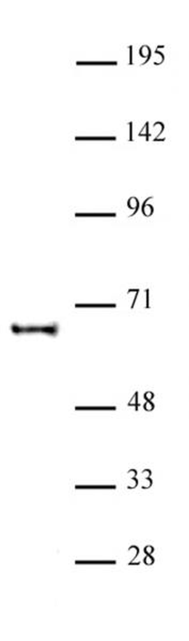 KAT5 Antibody in Western Blot (WB)