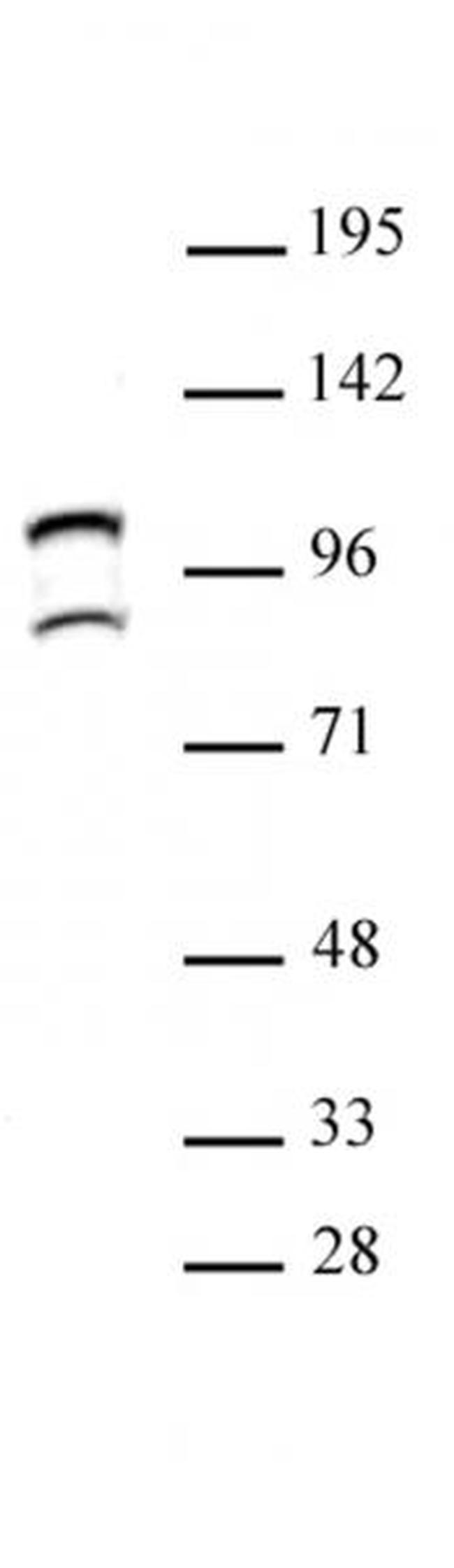 STAT6 Antibody in Western Blot (WB)