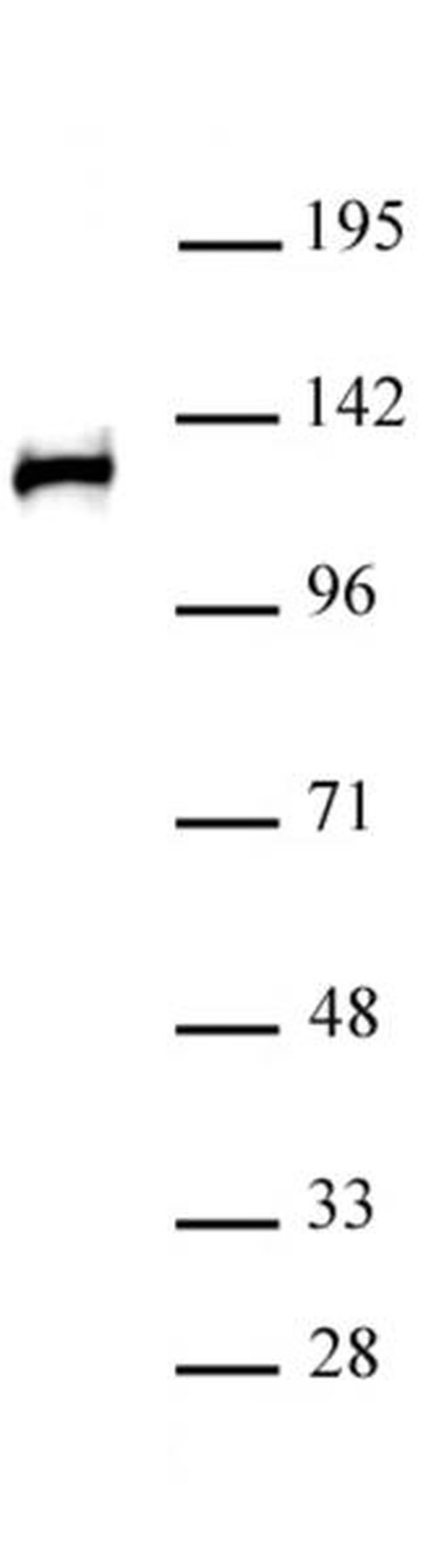 POLR2B Antibody in Western Blot (WB)