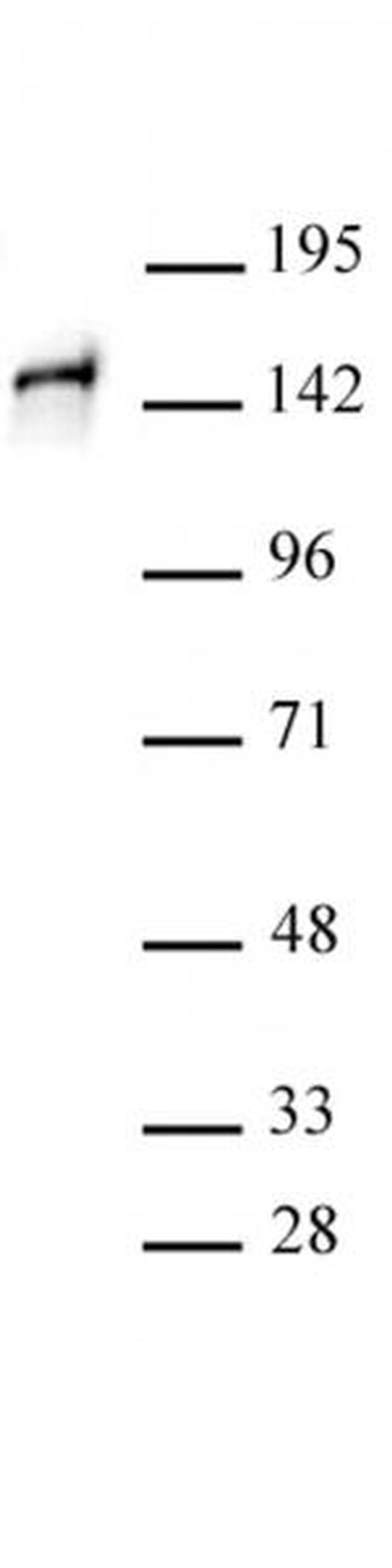 STAG1 Antibody in Western Blot (WB)