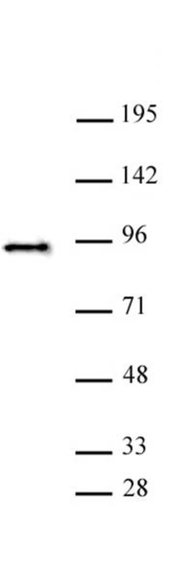 SATB2 Antibody in Western Blot (WB)
