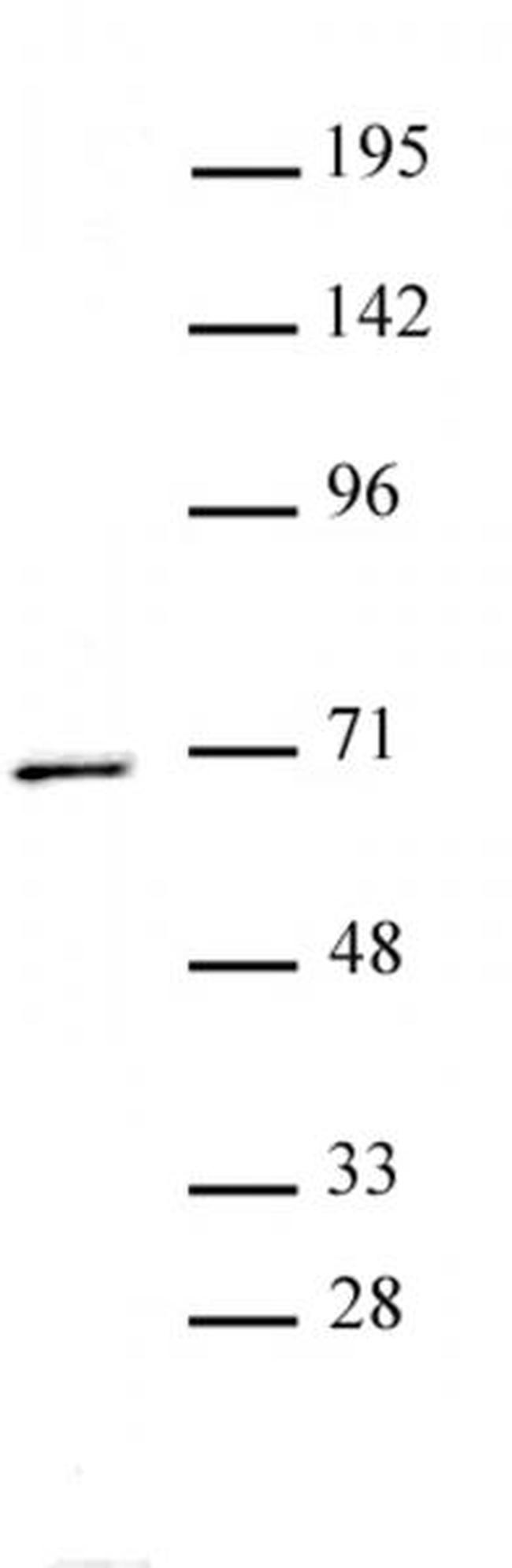 PPM1D Antibody in Western Blot (WB)