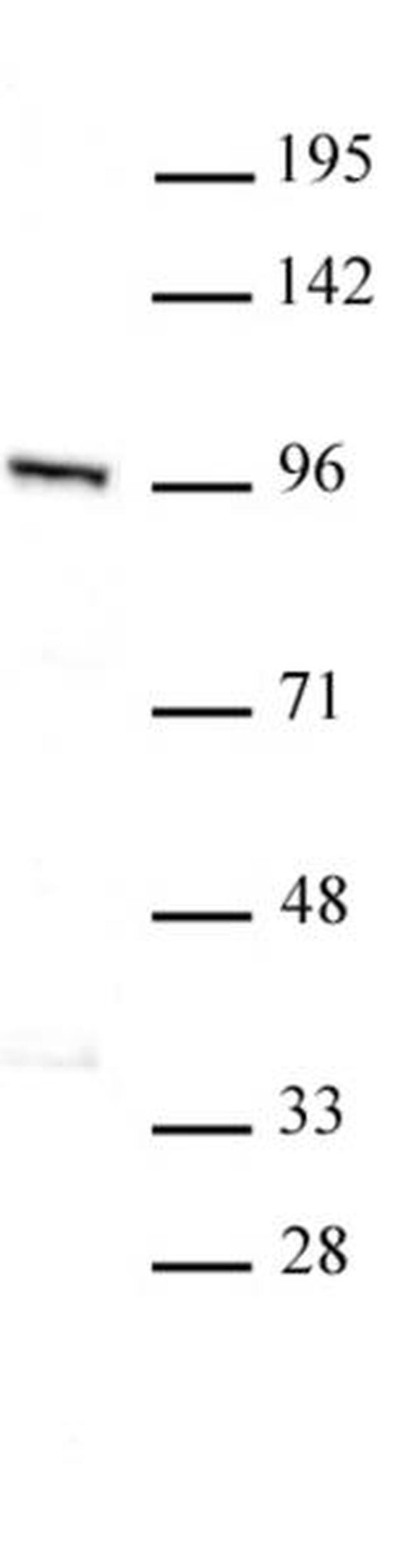 LSH Antibody in Western Blot (WB)
