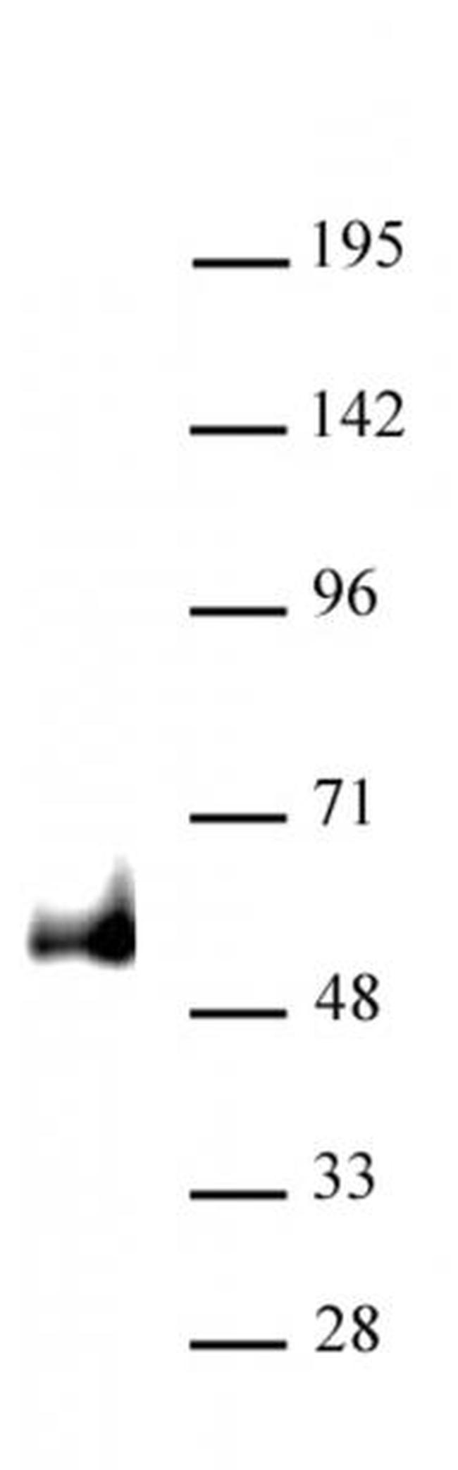 PAX6 Antibody in Western Blot (WB)